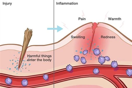 Anti-inflammatory effect Anti-inflammatory effect