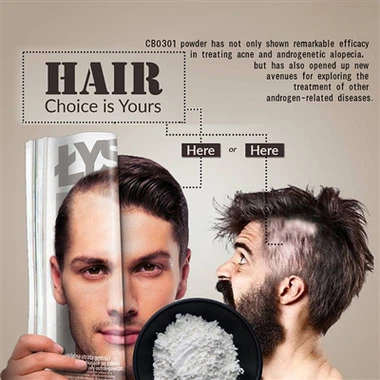 Γιατί έχω ακμή στο τριχωτό της κεφαλής μου; Οι ειδικοί εξηγούν την ακμή και τ...