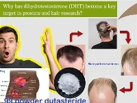 Γιατί η DHT έχει γίνει βασικός στόχος στην έρευνα για τον προστάτη και τα μαλλιά