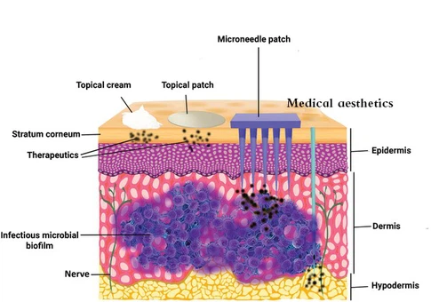 64Dipeptide Diaminobutyroyl Benzylamide Diacetate Powder 64Dipeptide Diaminobutyroyl Benzylamide Diacetate Powder